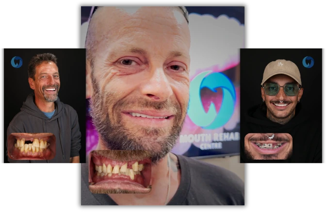 Three patients of Mouth Rehab Center partner clinics photographed at their consultations, each shown with a close-up view of their teeth