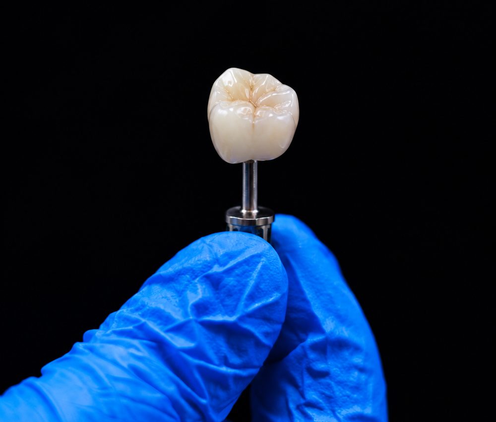 A dental professional in a blue glove holding a shade-matched ceramic crown, photographed against a black background